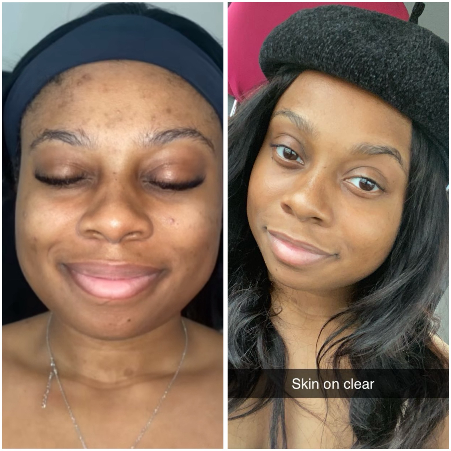 Calendula Moisturizer